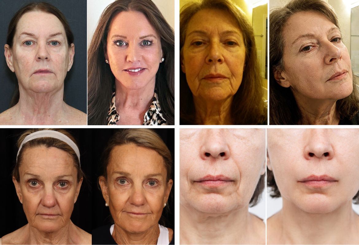 Before and after transformation collage showing multiple results